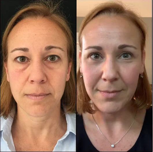 before-afters