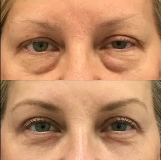 before-afters