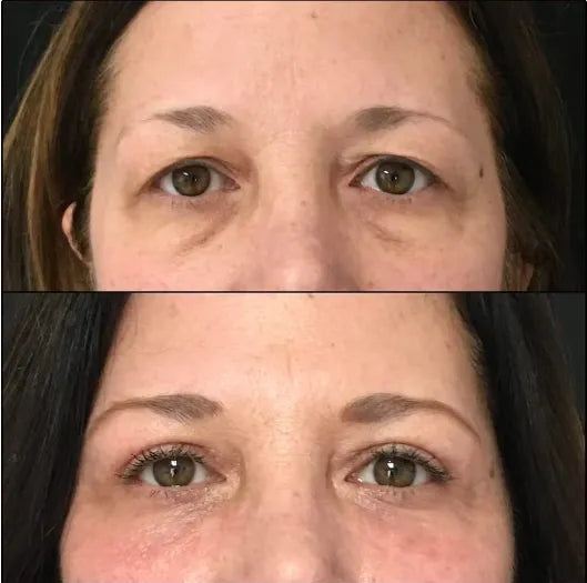 before-afters